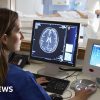 Royal United Hospital Bath marks 50 years of radiology